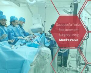 heart valve replacement surgery